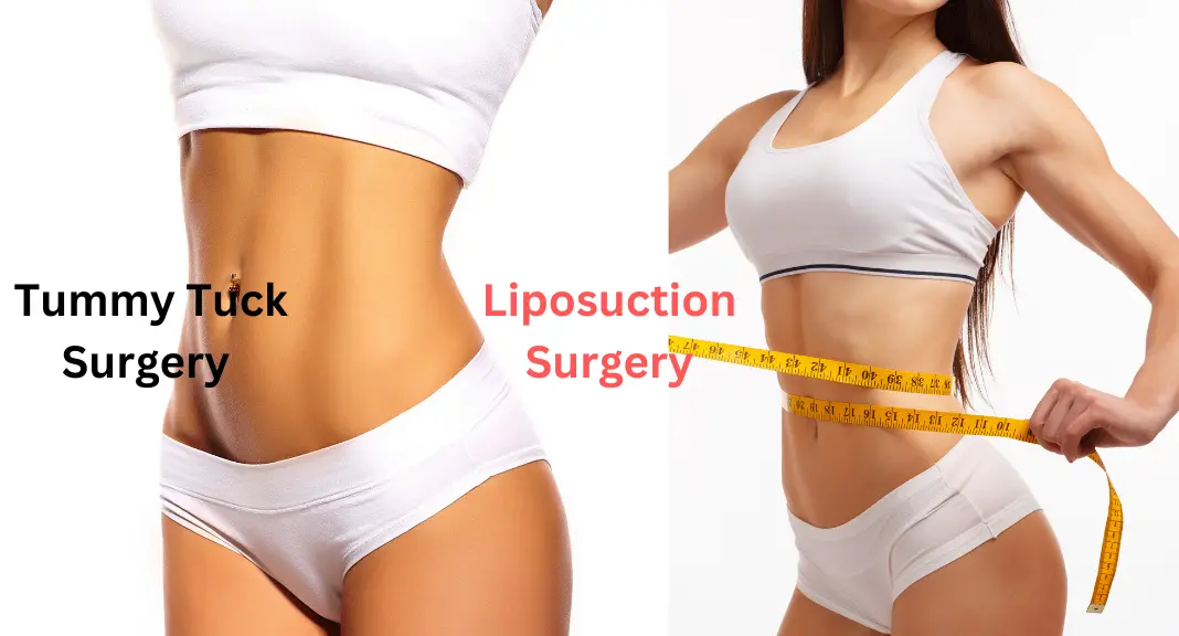 What is the Difference Between a Tummy Tuck and Liposuction?, Philadelphia Tummy  Tuck and Liposuction