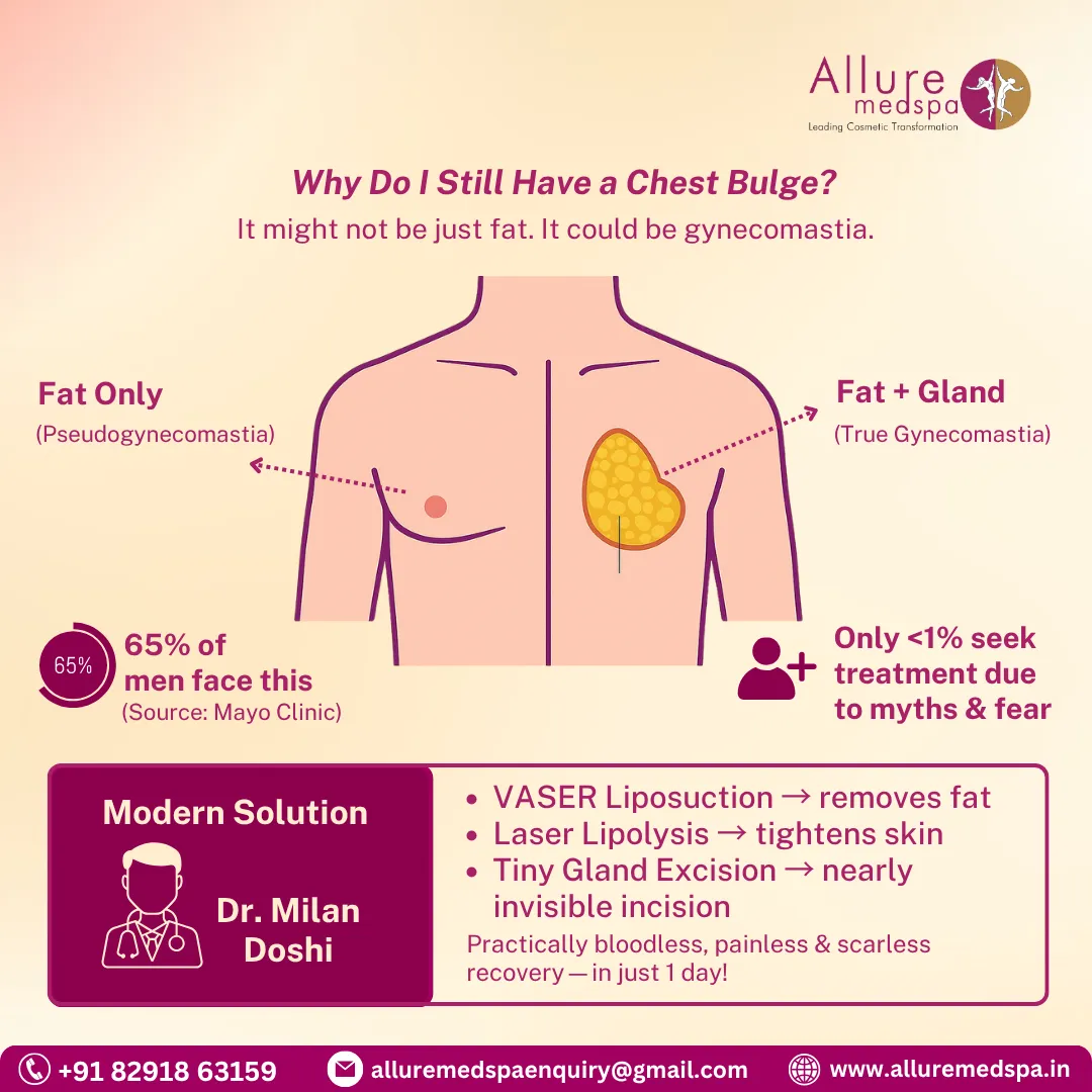 What-is-Gynecomastia