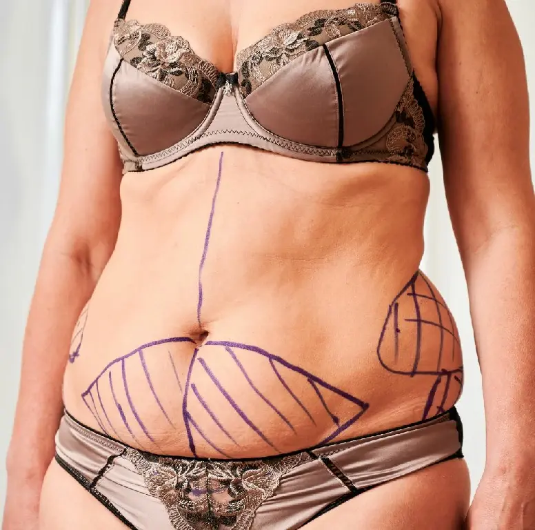 Body Surgery